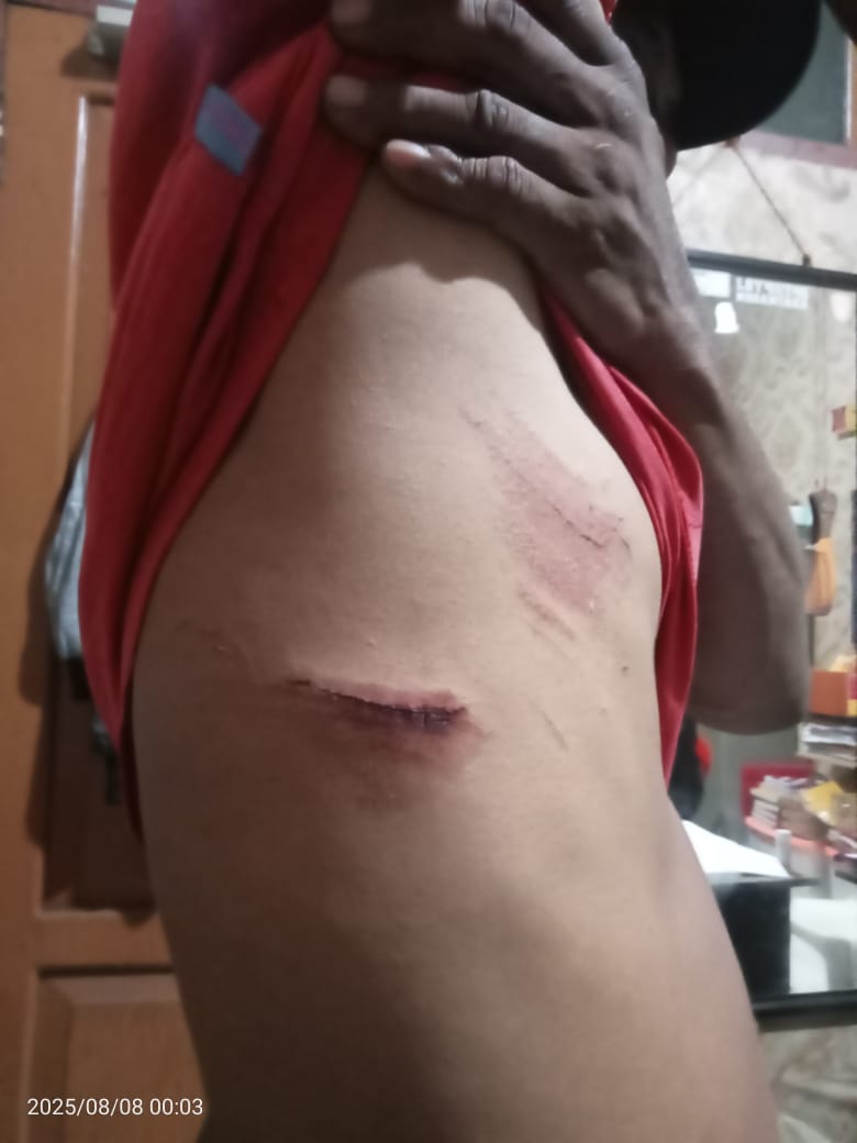 Jurnalis Diduga Dianiaya, Rekaman Dirampas di Nunukan, Putusan MA Diabaikan