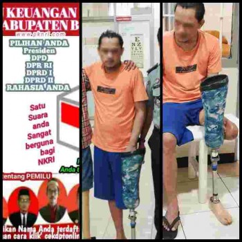 Wujud Kepedulian, Rutan Cipinang Berikan Kaki Palsu Untuk Warga Binaan Penyandang Disabilitas